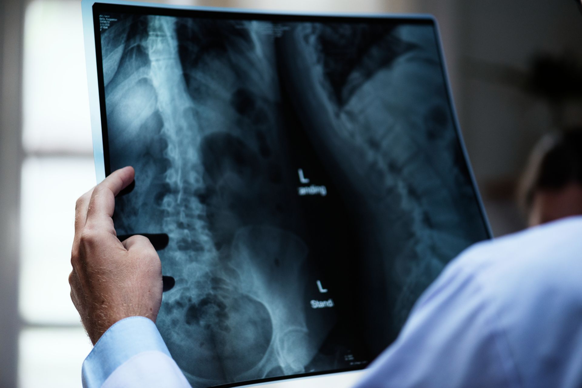 Imagerie médicale pour radiologie